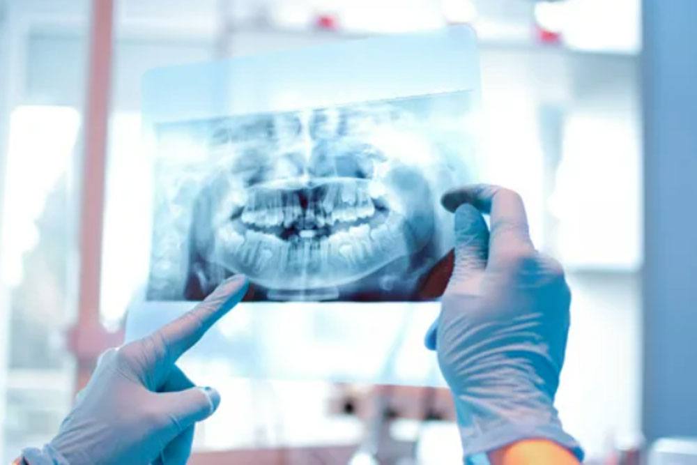 dental-radiography-img dental-radiography-img